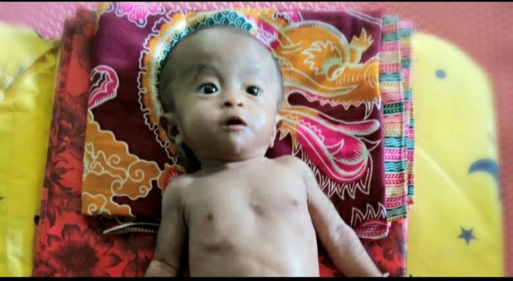 Bayi Jantung Bocor Harapkan Bantuan di Waylima, Pesawaran