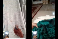 Janggal, Polisi Tidak Temukan Bercak Darah dan Proyektil Peluru di TKP Habib Bahar Ditembak