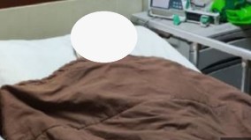    Sudah Dibor Kepalanya Namun Operasi Tumor Otak Pasien Epiyana Ditunda, RS Santosa Sebut Back Up Alat Tak Masuk Kriteria