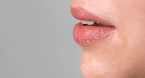 Mengatasi Bibir Pecah: 10 Tips Ampuh untuk Bibir Lebih Sehat