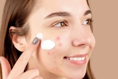 Rekomendasi Kandungan Basic Skincare untuk Kulit yang Berjerawat