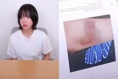 Geger Youtuber Mukbang Asal Korea Jadi Korban Kekerasan hingga Pemerasan dari Mantan Pacar