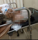 Remaja Korban Geng Motor Koma di RSUDAM, Pelaku Masih Bebas