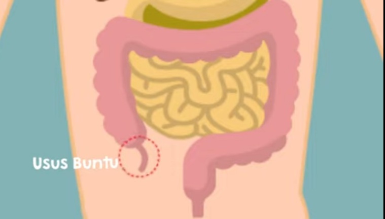 Penyakit Usus Buntu Penyebab Pencegahan Dan Cara Mengobatinya Helo Indonesia 